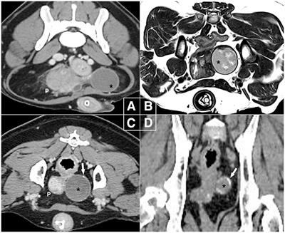 Laparoscopic treatment of paraprostatic cyst in two dogs – complete resection, and partial resection with omentalization: a case report
